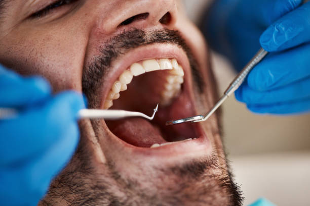 Best Emergency Treatment for Oral Infections in Hudson Lake, IN